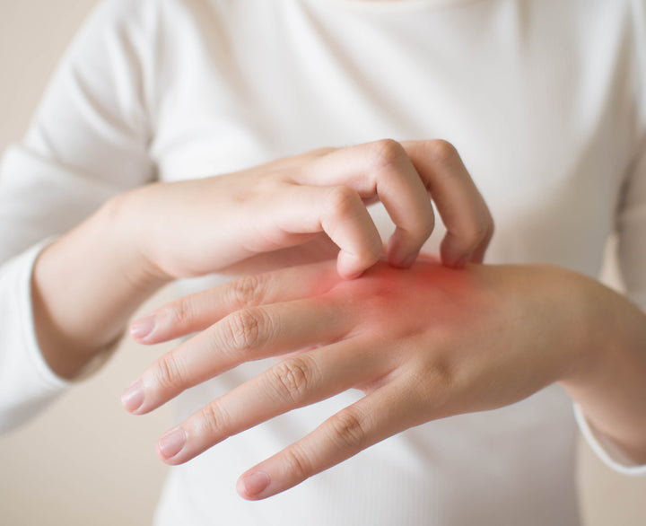 Neurodermatitis or atopic eczema