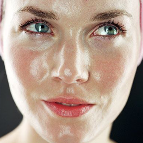 Oily or greasy skin